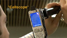 Using a Cellscope